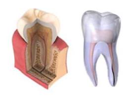 Лечение временных зубов. Некроз пульпы 2