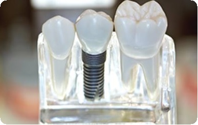 Микрохирургия в стоматологии: показания, этапы, последствия2
