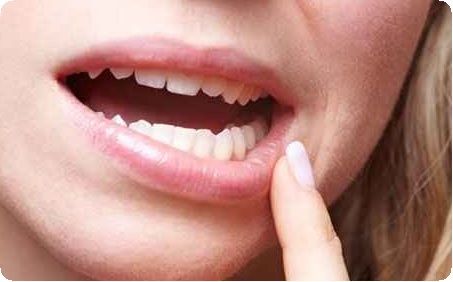Осложнения в стоматологии после операции: предотвращение, устранение, лекарственные препараты2