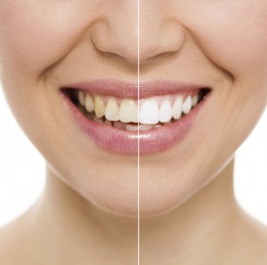 Адгезия в стоматологии: взаимодействие, достоинства, недостатки2