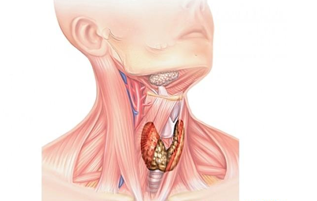 Киста щитовидной железы: лечение, правой и левой доли, фото, видео3