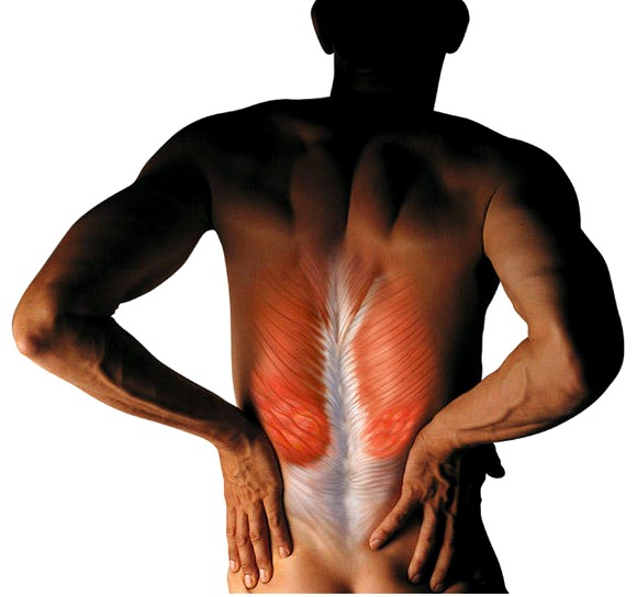 Что делать, если болит спина?3