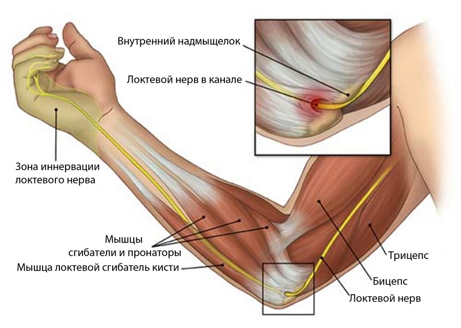 Боль в локте: причины и лечение, боли от плеча до локтя3