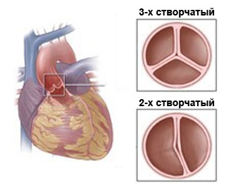 Синдром малого сердечного выброса: лечение, диагностика3