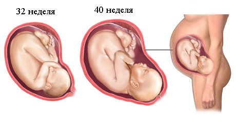 Почему болит живот при беременности у женщин?4