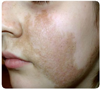 Симптомы заболевания кожи. Общие положения4