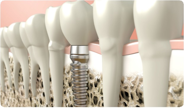 Альтернативное лечение. Применение альтернативной терапии в стоматологии3