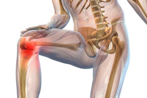 Почему болят колени после тренировки?5