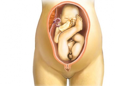 Перенашивание беременности. Последствия для ребенка5