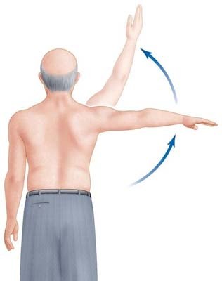 Боль в плечевом суставе: симптомы, лечение, причины, дискомфорт при поднятии руки5