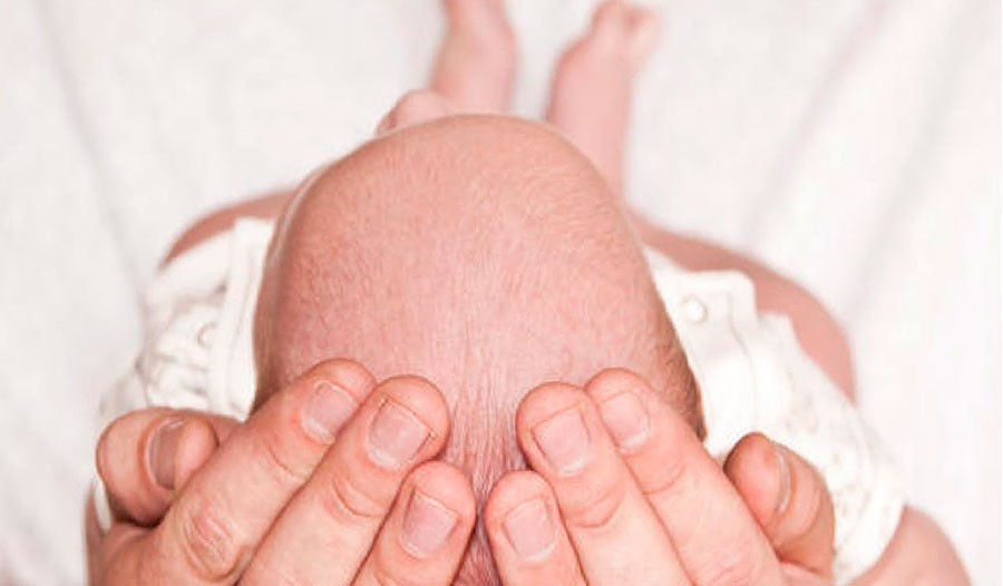Себорейный дерматит у новорожденных6