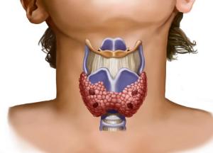 Гормональный сбой щитовидной железы: причины, лечение, лекарственные препараты6