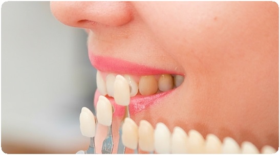 Реставрация депульпированных зубов. Основные компоненты6