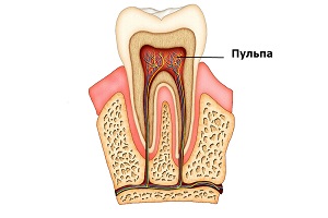 Перелом корня зуба: лечение, методики терапии6