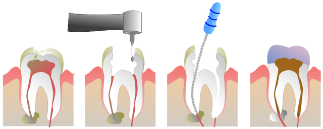 Седативные препараты в стоматологии 7