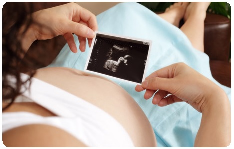 Беременность двойней: диагностика, ведение беременности8