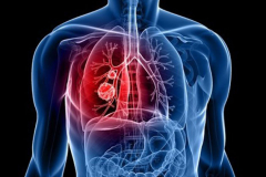 Болезни лёгких
