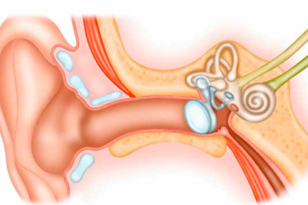 Почему болят уши внутри