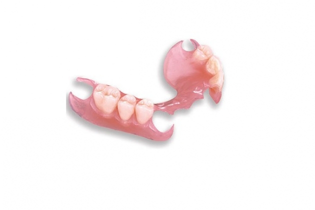 Перекрывающие зубные протезы