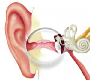 Почему болят уши внутри: причины, последствия3