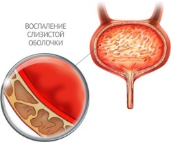Боль в правом боку внизу живота у женщин во время полового акта thumbnail