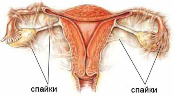 Боль в правом боку внизу живота у женщин при половом акте thumbnail
