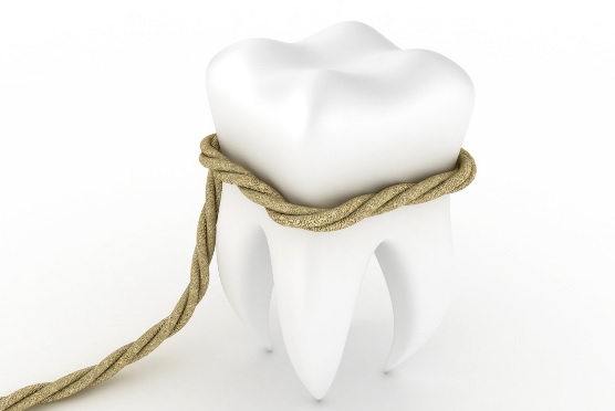 Корневые каналы молочных зубов. Пломбирование корневых каналов временных зубов7